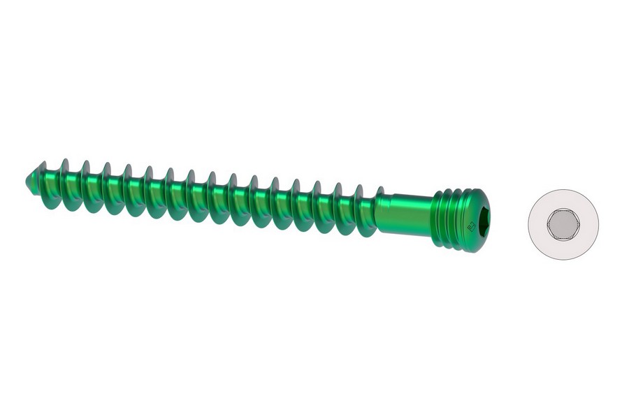 LC-LCP Cancellous Screw 6.5mm for LCP Proximal femur Plate		 